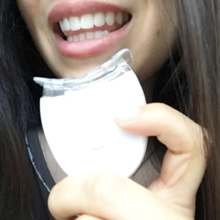 33999 nu smile teeth whitening custom tray