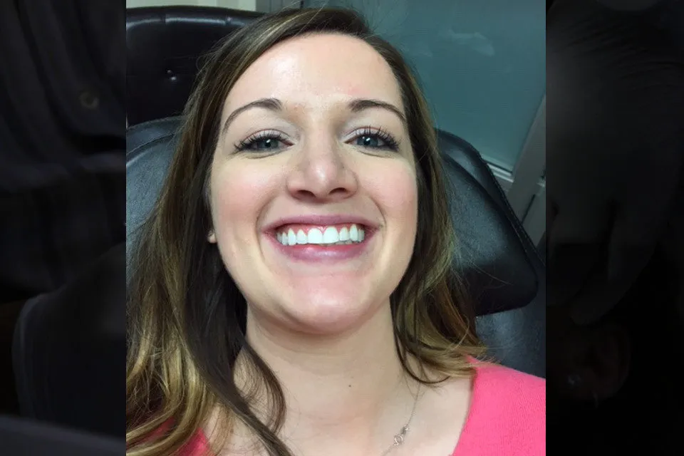 34011 maintaining white smile