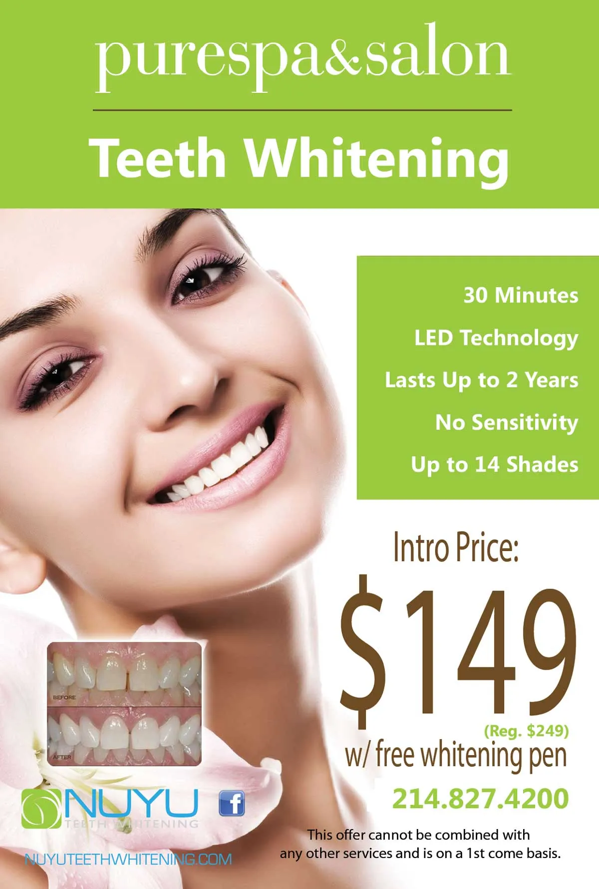34011 teeth whitening fort worth intro