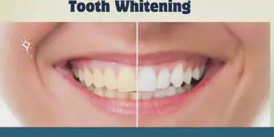 /img/34051-teeth-whitening-results.webp