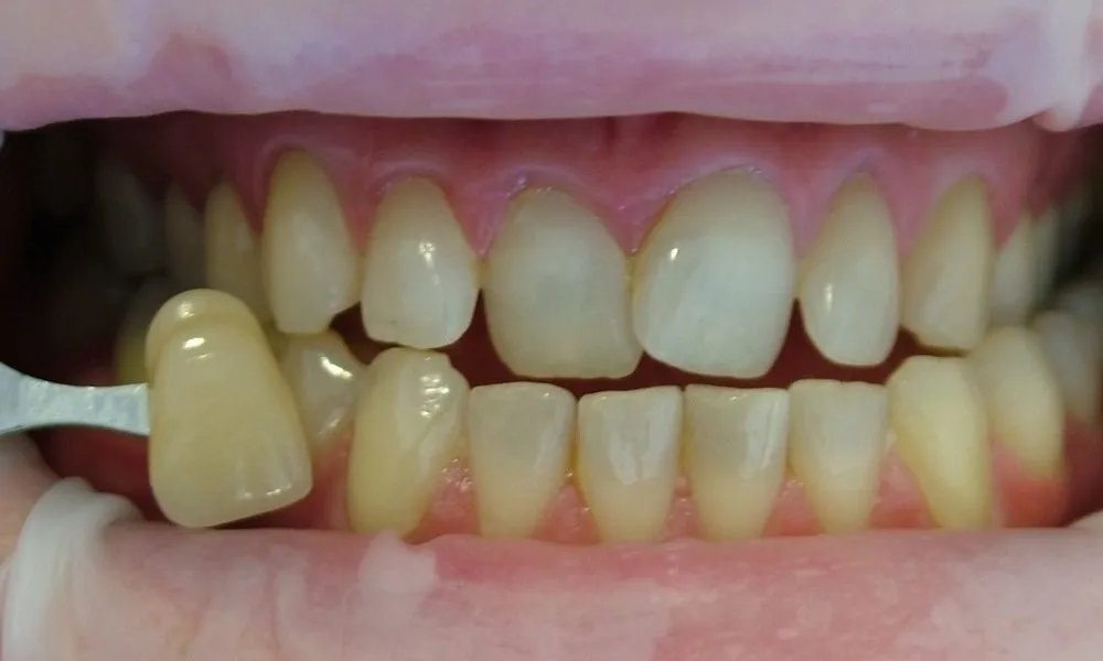 34058 avoiding staining foods