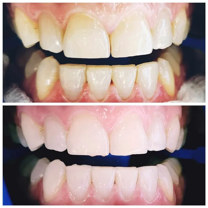 34058 oral hygiene practices