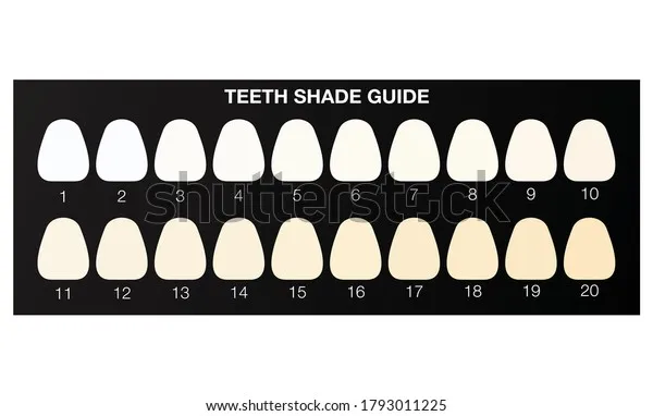 34061 teeth whitening before after
