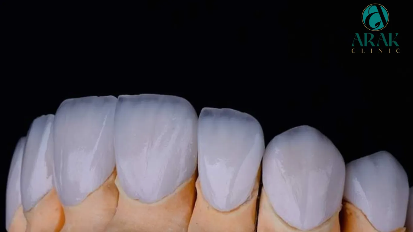 34062 zoom teeth whitening alternatives