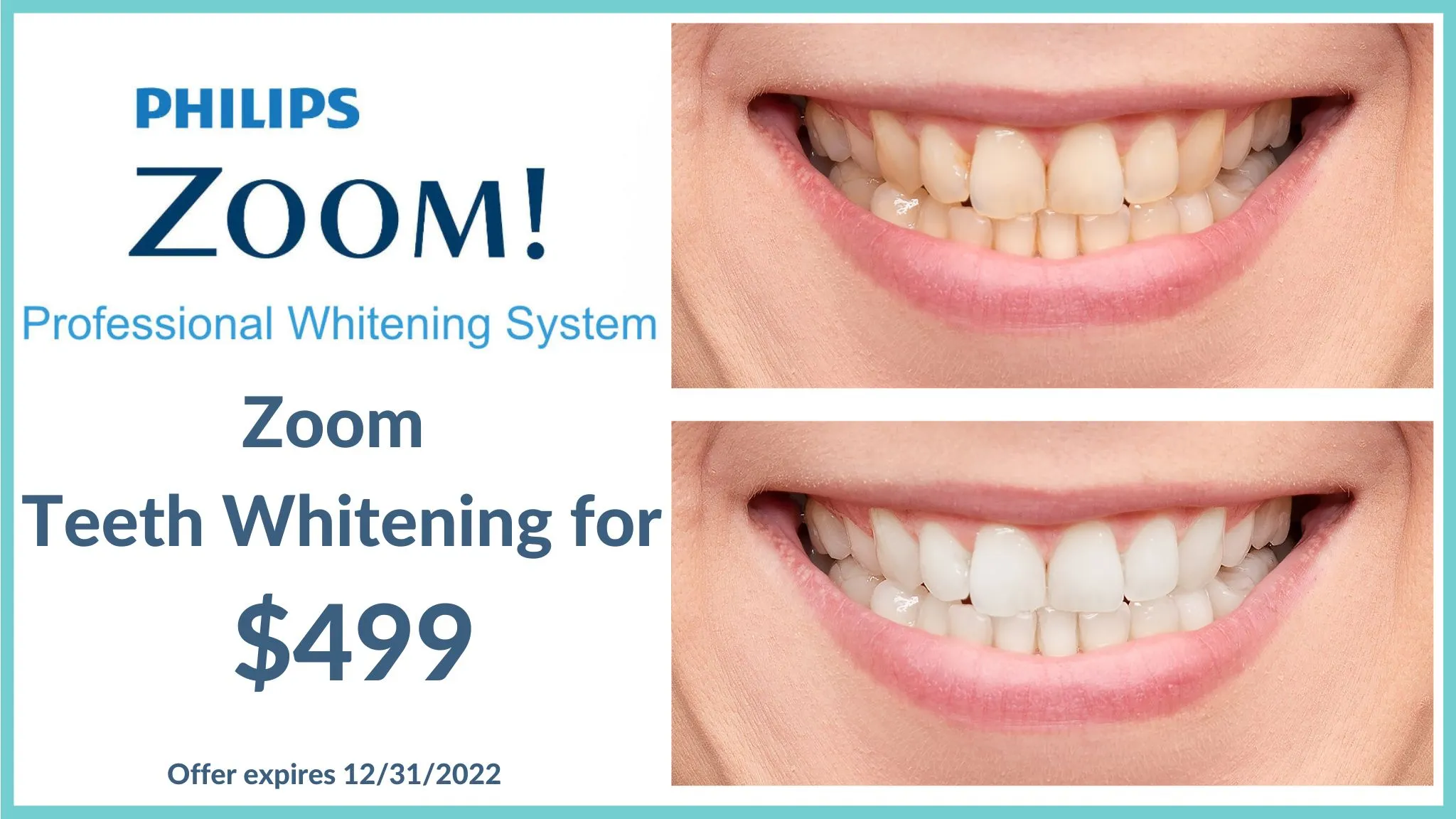 /img/34062-zoom-teeth-whitening-safety.webp
