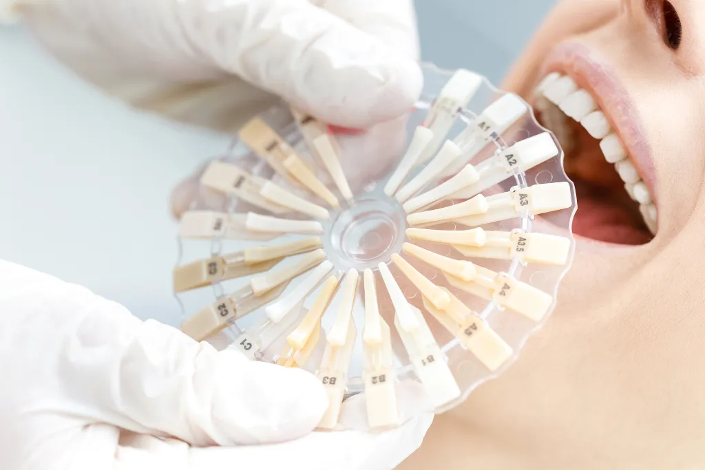 34063 van nuys dentist teeth whitening