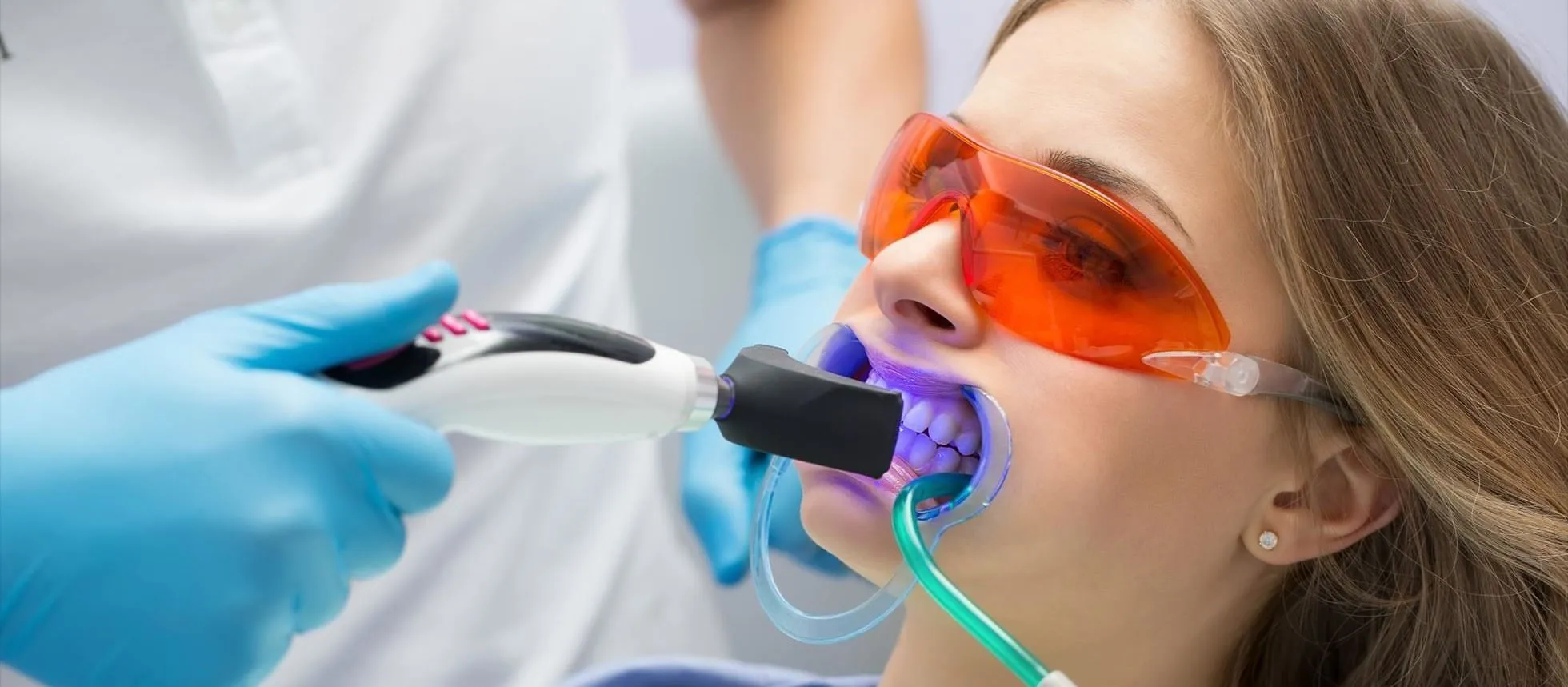 34066 professional teeth whitening