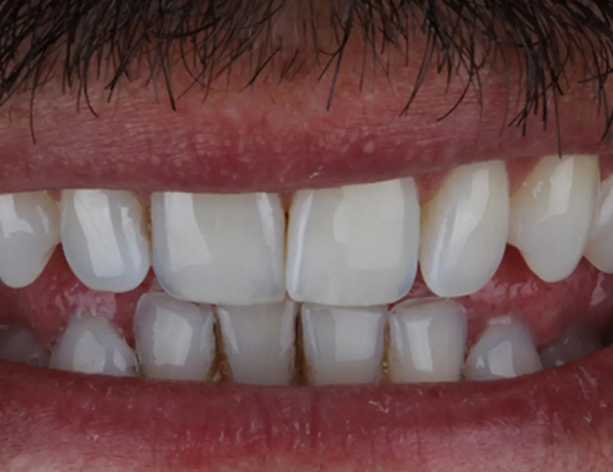 /img/34072-teeth-whitening-clinic-queens.webp