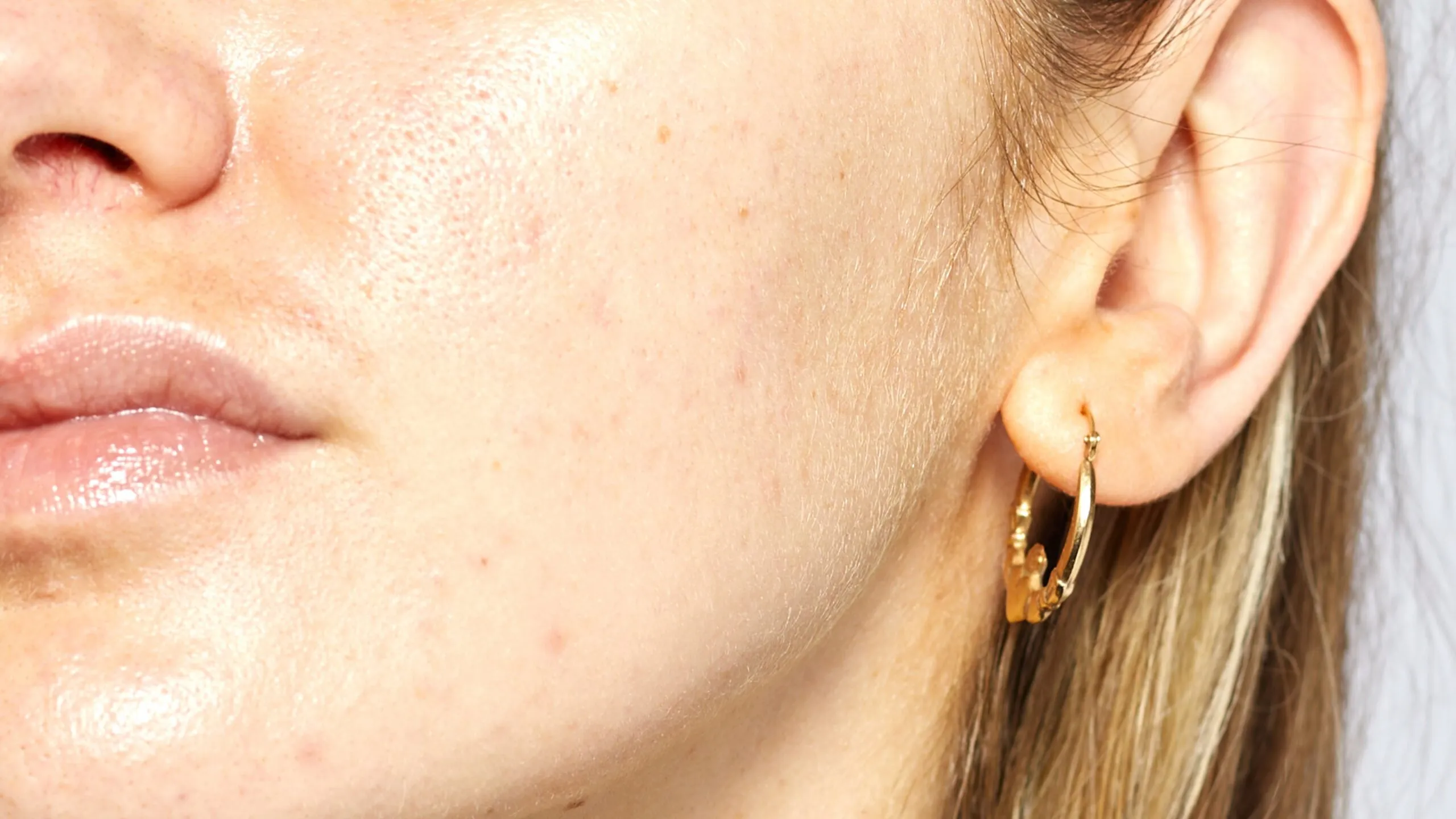 34073 teeth whitening gels