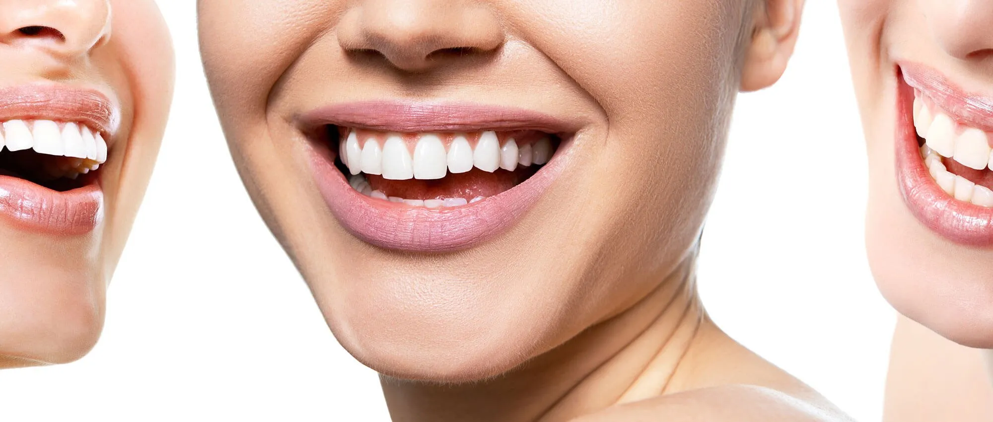 34074 at home teeth whitening summerville sc
