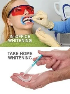 34074 types of teeth whitening summerville sc