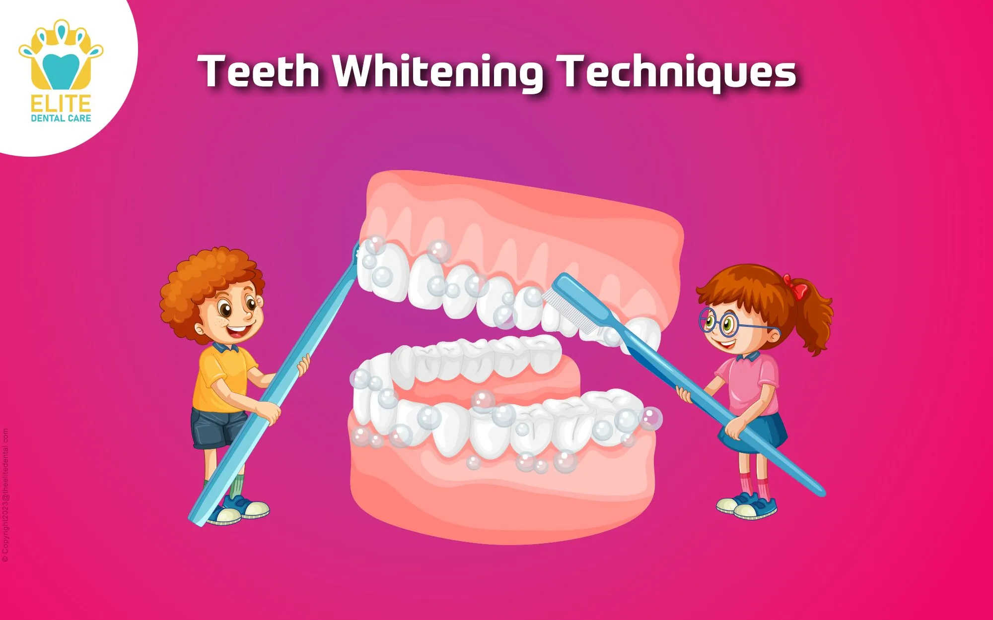 34081 custom tray whitening