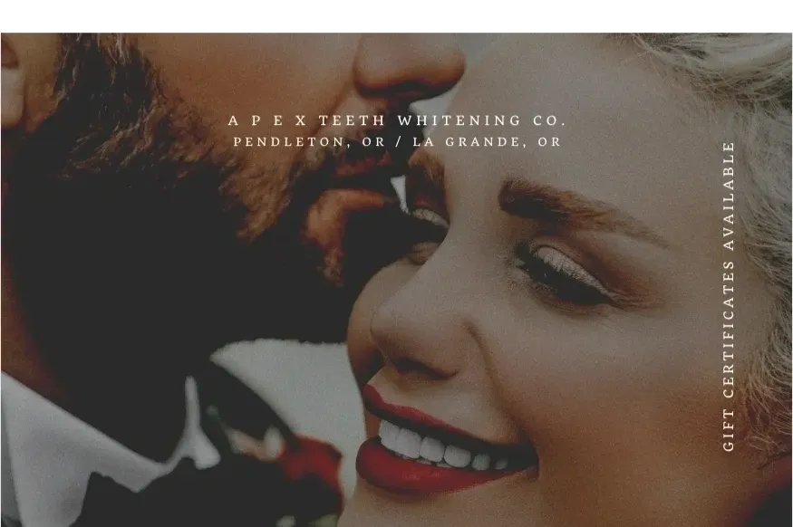 34082 in office teeth whitening