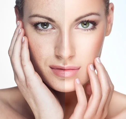 34088 sunscreen protection