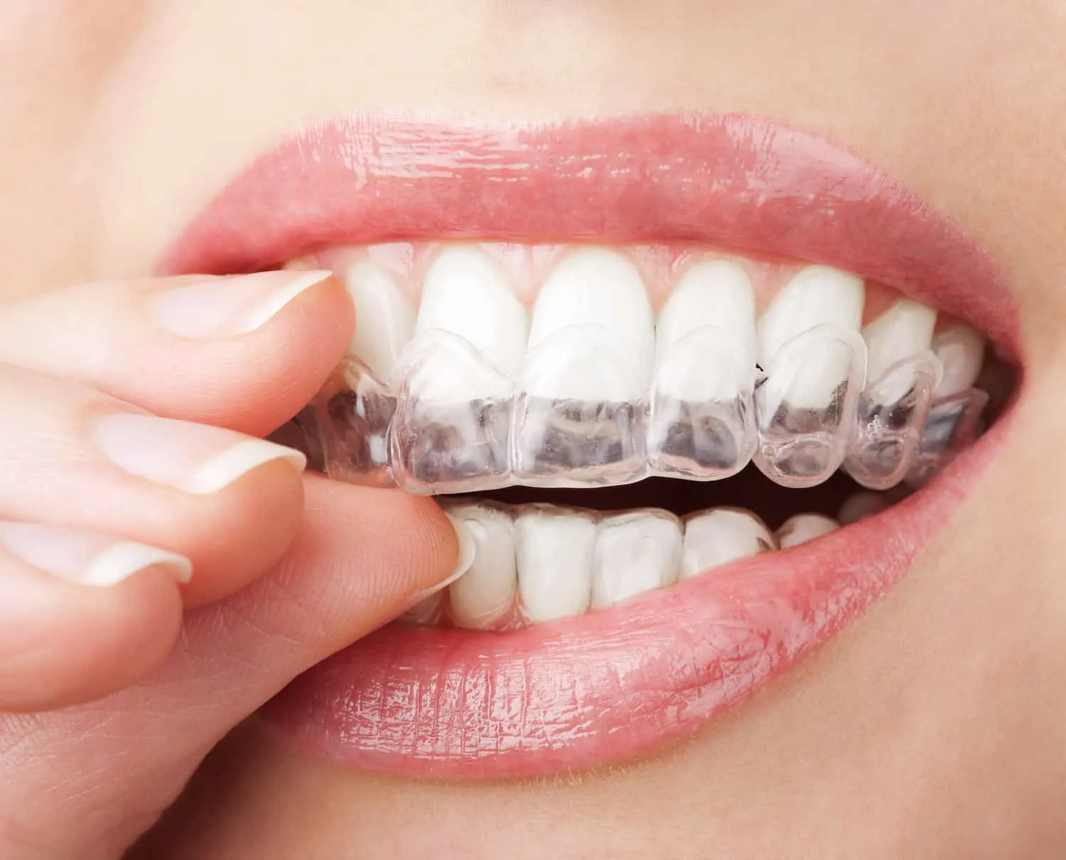 /img/34103-teeth-whitening-guide.webp
