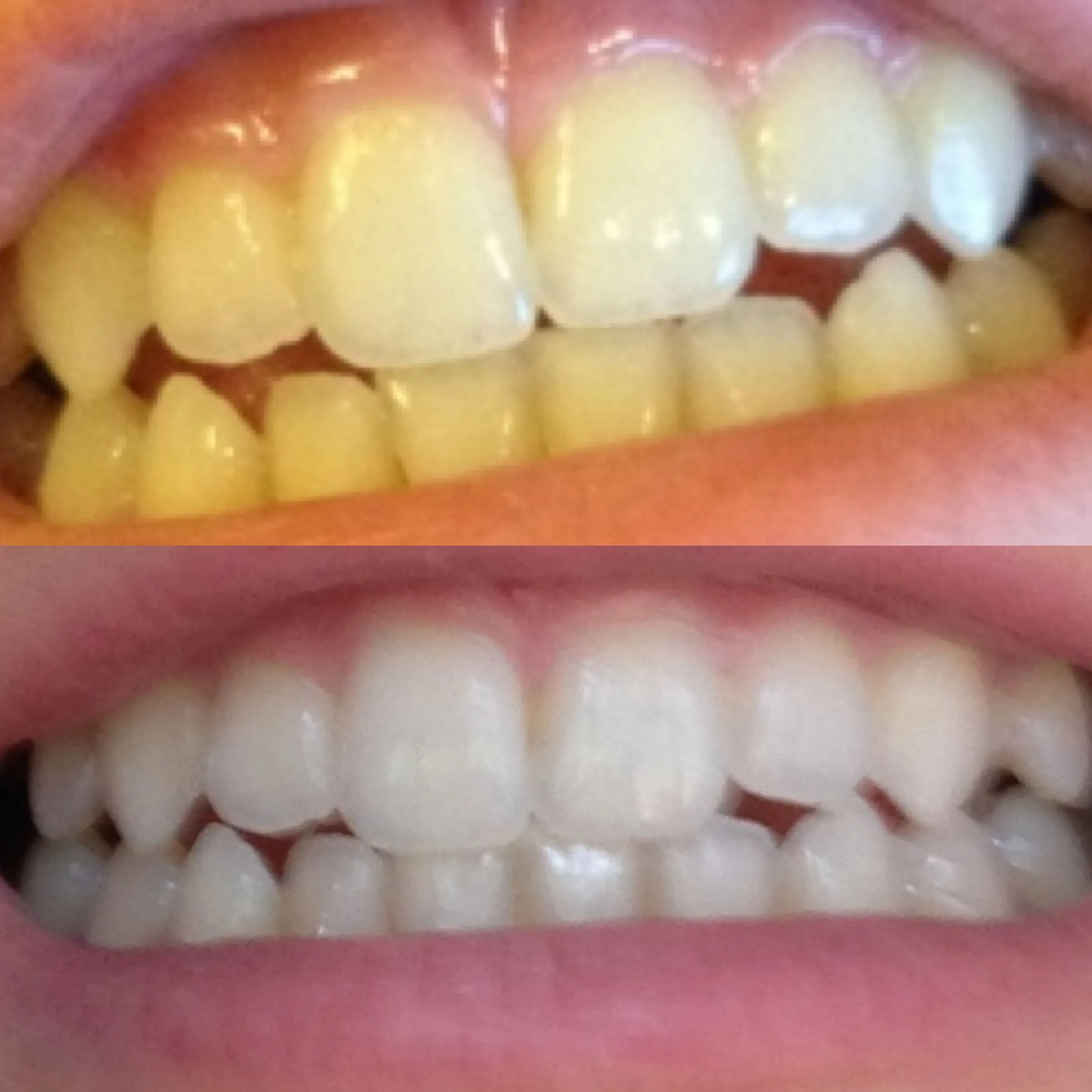 /img/34115-alternative-teeth-whitening.webp