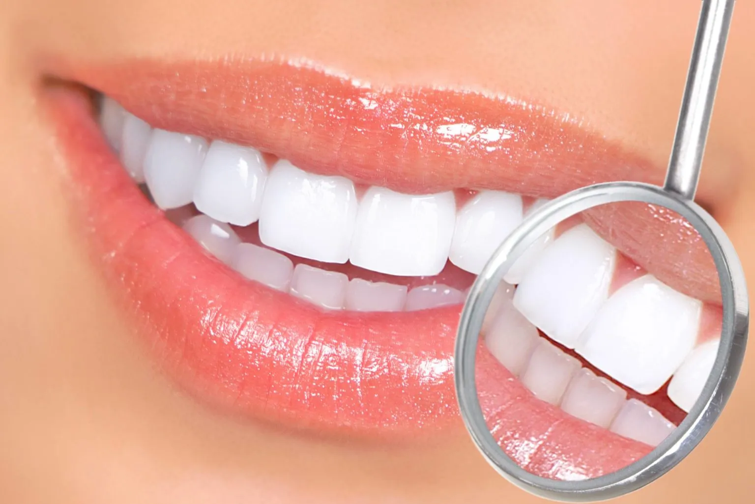 34120 teeth whitening procedure