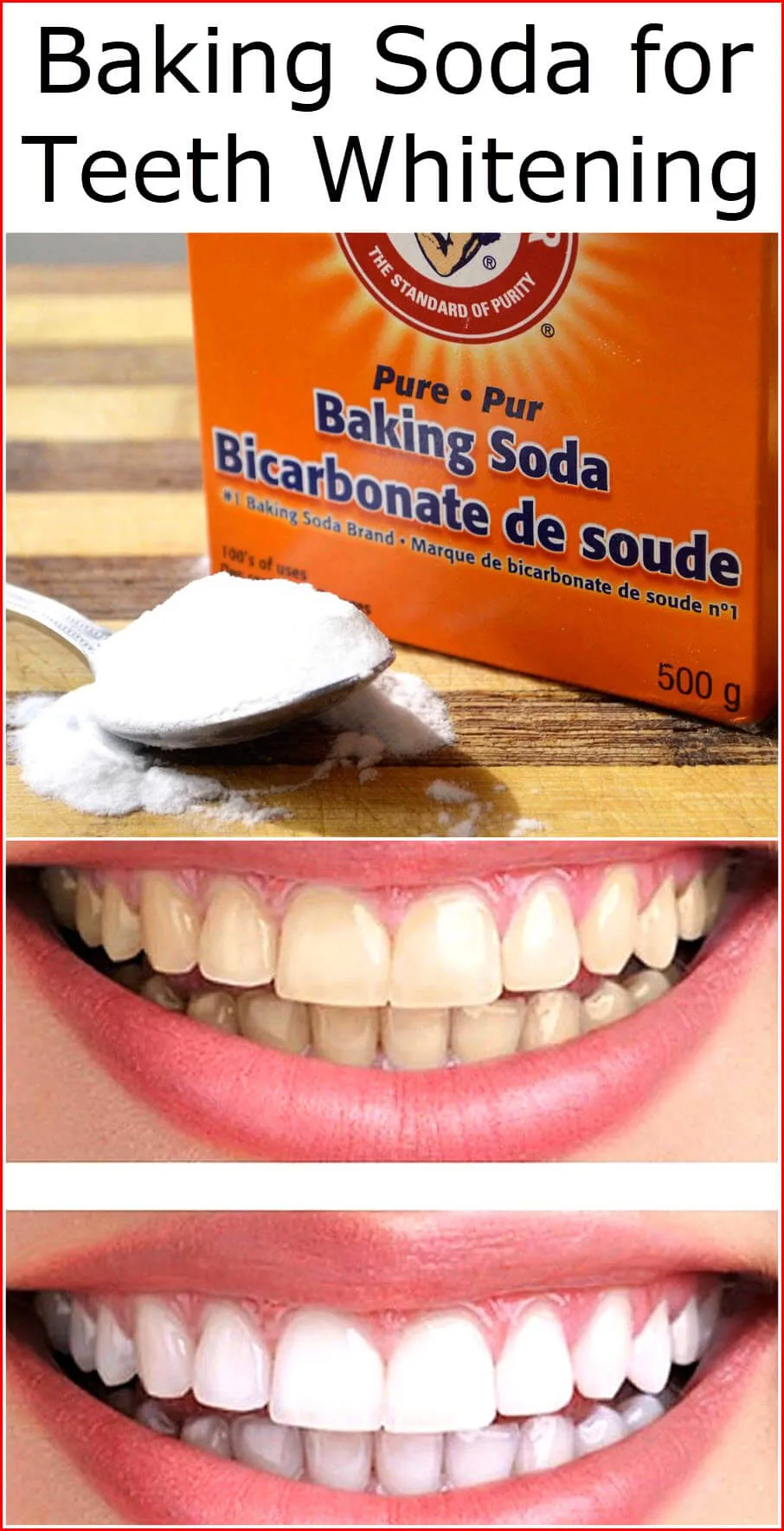 34125 baking soda teeth whitening 1