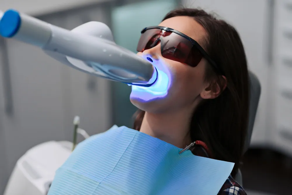 34126 teeth whitening touch up