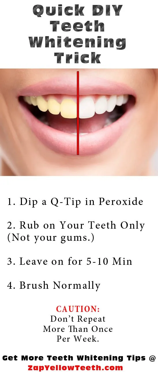 34135 teeth whitening tips