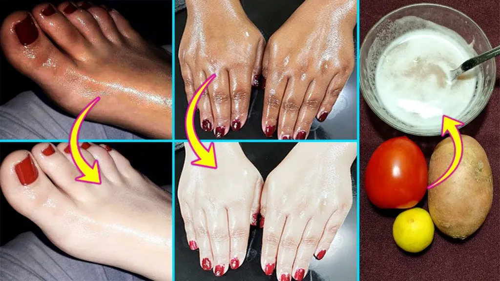 34139 chemical peel hand