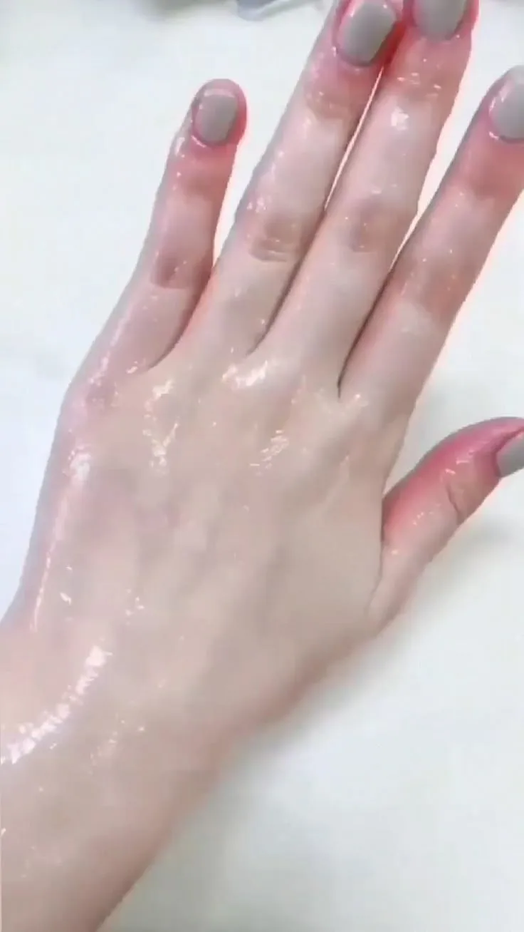 34139 hand exfoliation