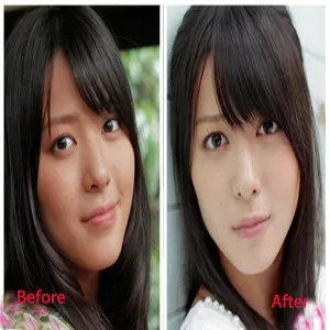 34140 skin whitening injections pakistan