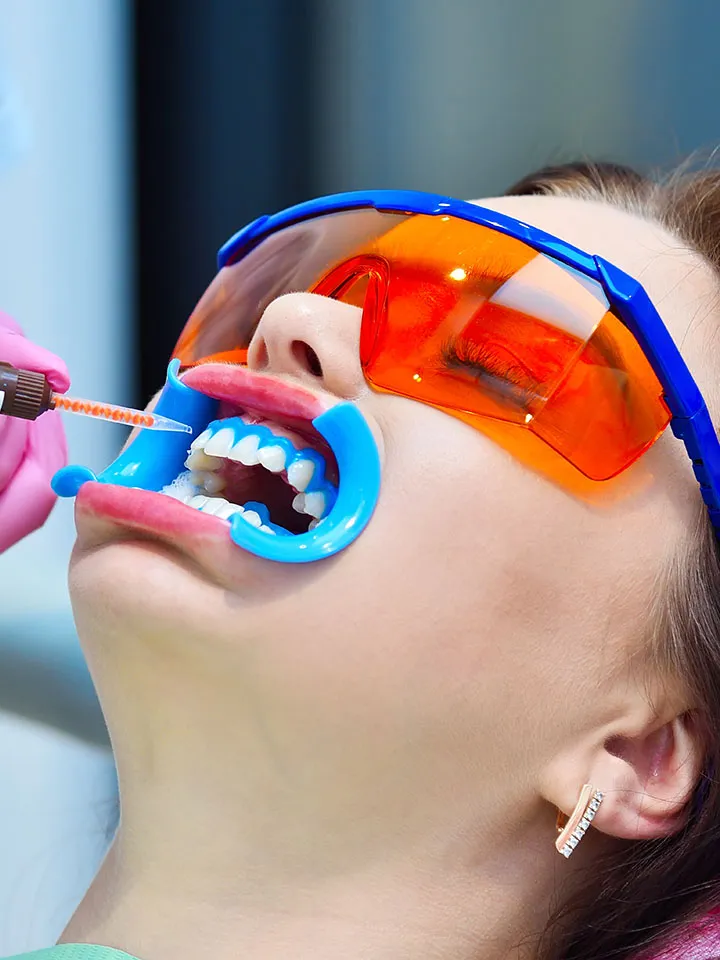 34141 whitening agent application