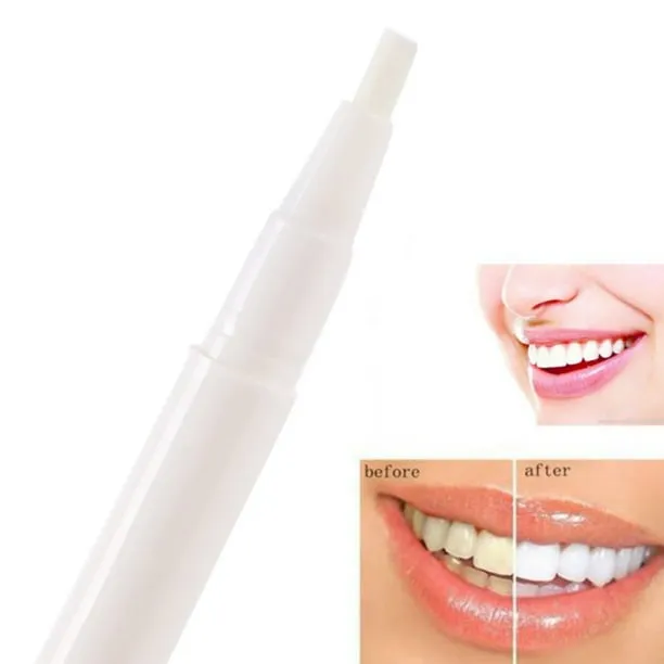 34143 teeth whitening results