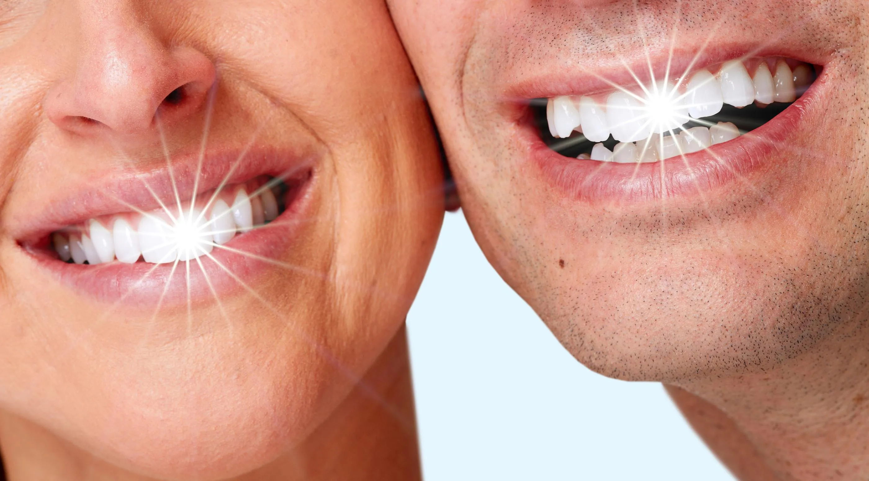 34146 teeth whitening sioux falls 6