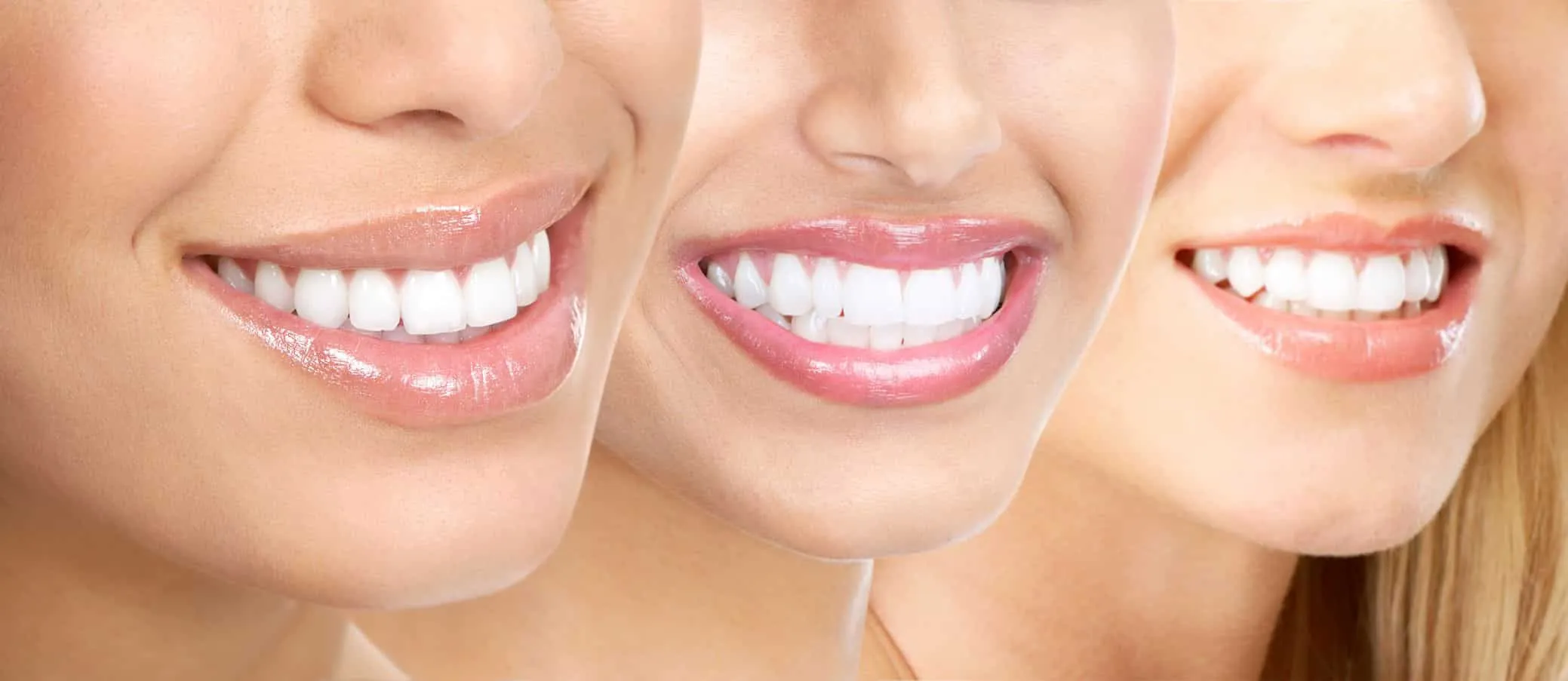 /img/34146-teeth-whitening-sioux-falls-7.webp