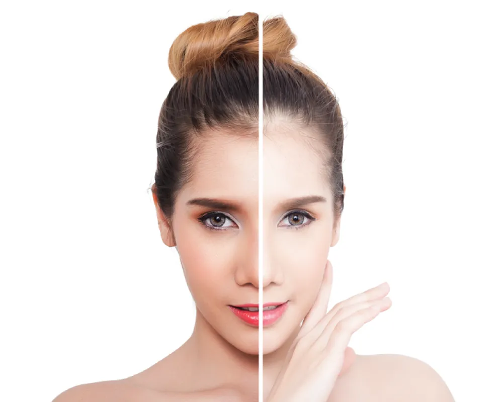 34150 yogurt honey skin