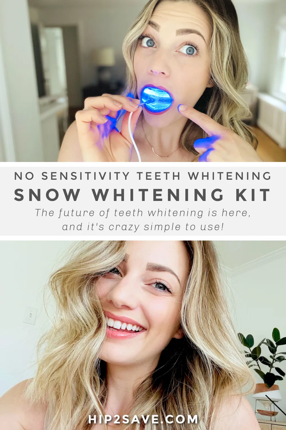 34154 snow teeth whitening vs dentist