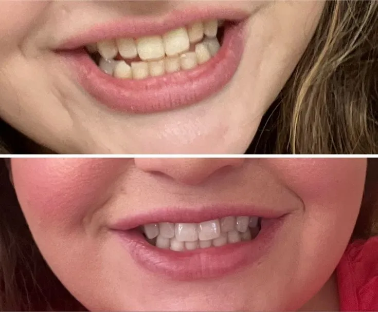 34154 snow wand application