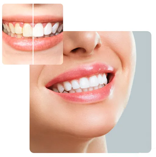/img/34159-oral-hygiene-practices.webp