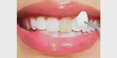 /img/34161-oral-hygiene-image8.webp