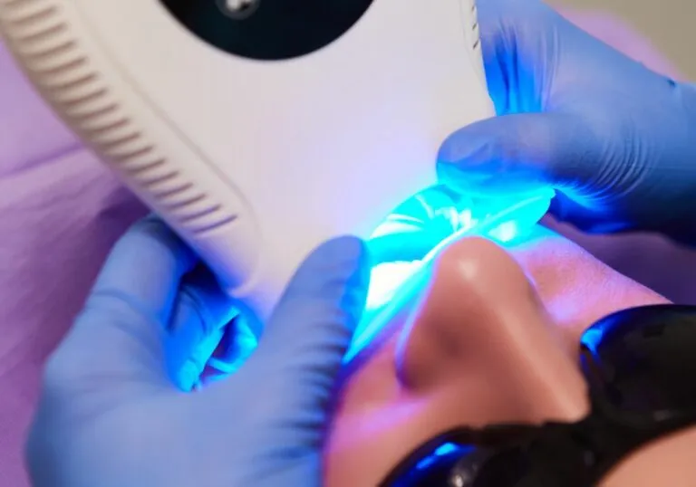 34163 at home teeth whitening