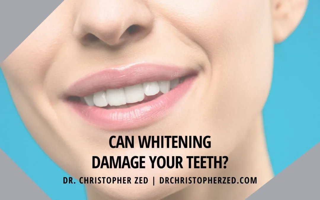 34163 professional teeth whitening