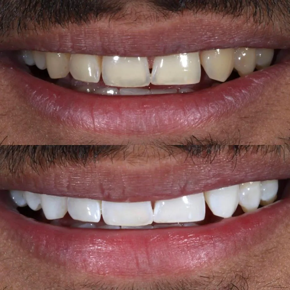 34167 user review teeth